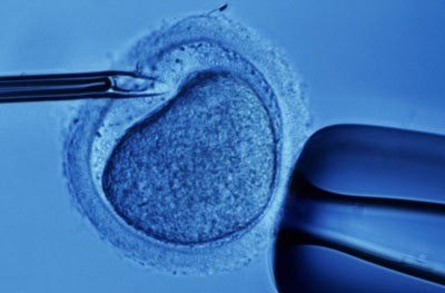 Ivf Treatment Increases Risk Of Divorce, New Study Shows